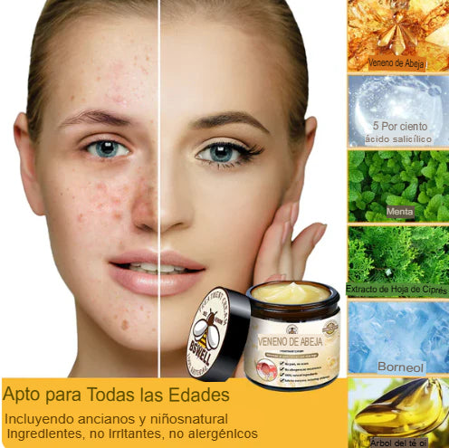 CREMA PARA ARTICULACION Y BERRUGAS VENENO DE ABEJAS 🐝 ¡ENVÍO GRATIS! 💎