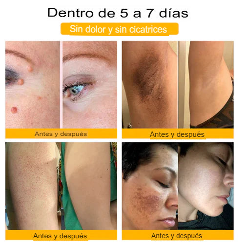 CREMA PARA ARTICULACION Y BERRUGAS VENENO DE ABEJAS 🐝 ¡ENVÍO GRATIS! 💎